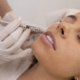 Differenze tra Filler e Botox
