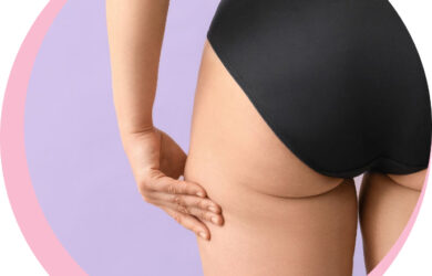 Come ridurre o eliminare le culotte de cheval